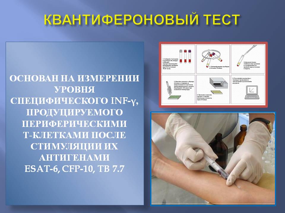 Купить справку квантифероновый тест Москве